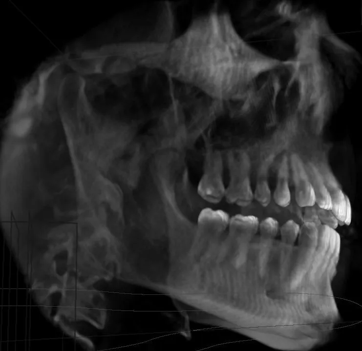 3D Imaging, Prosthodontics Corpus Christi TX Chad Allen DDS MS
